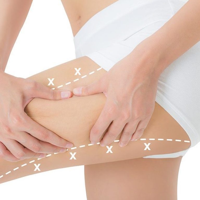 uyluk-germe-2-1024x675